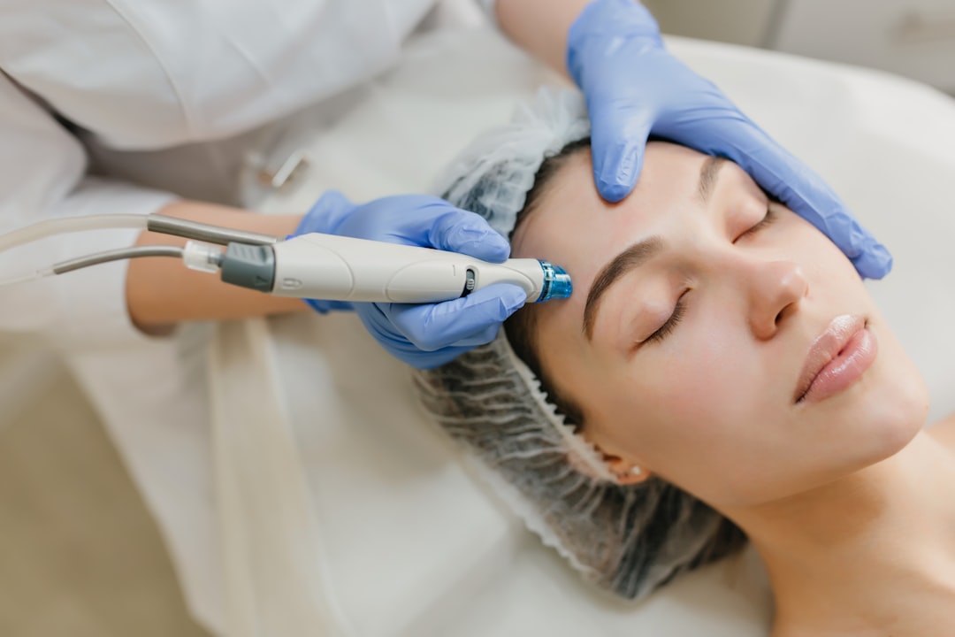 Clinical microneedling pen treatment being performed by an aesthetic practitioner in a medical setting — Photo by Unsplash
