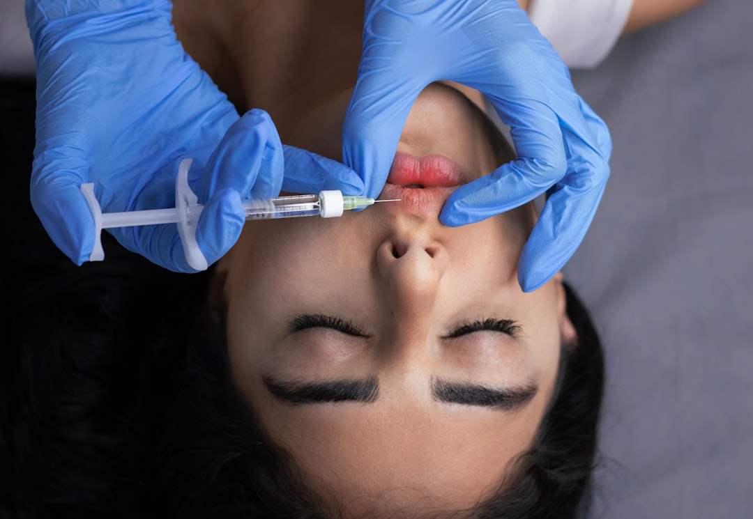Close-up overhead view of a lip filler injection being administered with a syringe and blue gloves at an aesthetic clinic