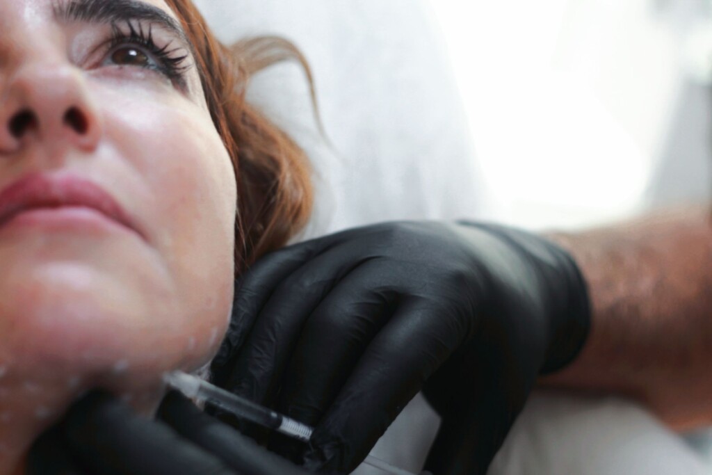 Injector in black gloves administering a dermal filler injection to a woman's lower face, illustrating precise cosmetic injection technique