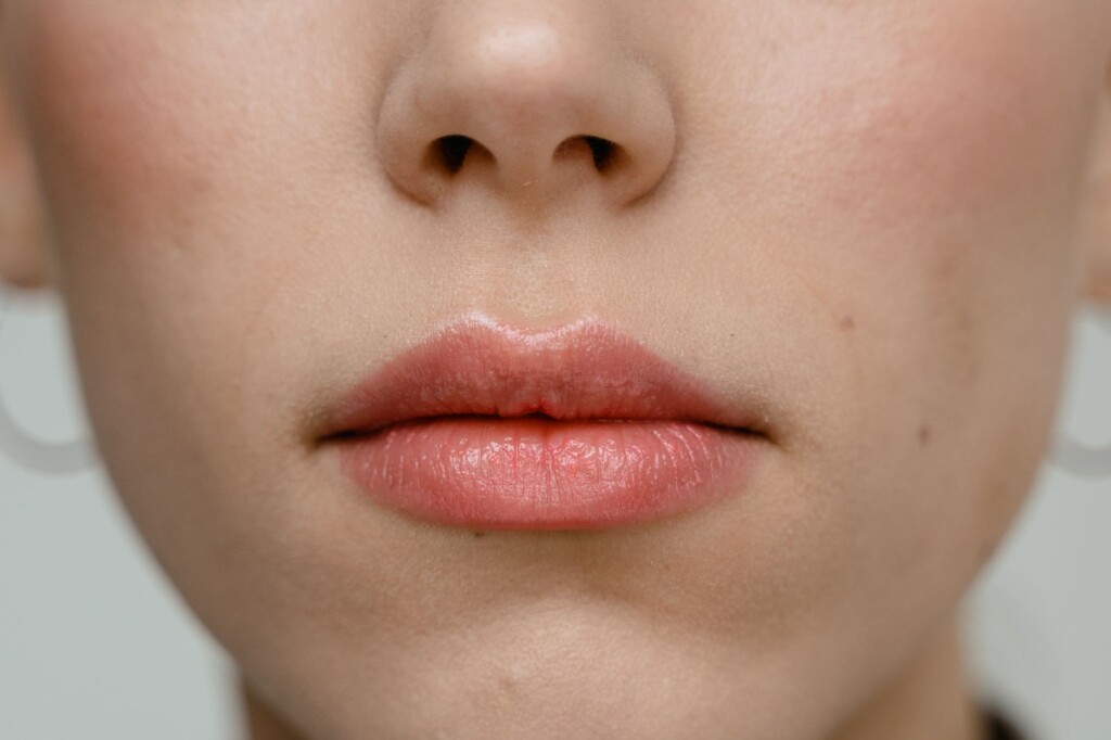 Close-up of a woman's natural lips showing subtle, well-defined shape and texture relevant to lip augmentation assessment
