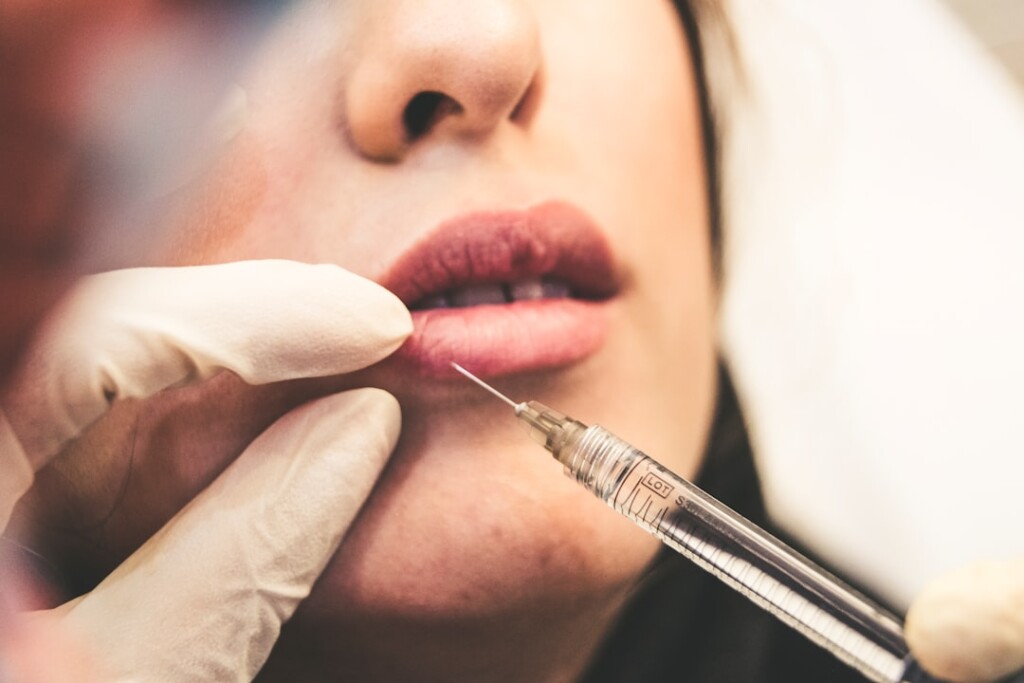 Gros plan sur une injection de produit de comblement des lèvres réalisée à l'aide d'une aiguille fine par un praticien portant des gants, illustrant la précision requise pour choisir un praticien qualifié spécialisé dans l'augmentation du volume des lèvres.